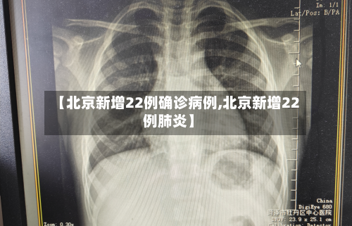 【北京新增22例确诊病例,北京新增22例肺炎】-第3张图片